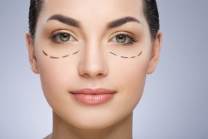 Blefaroplastia